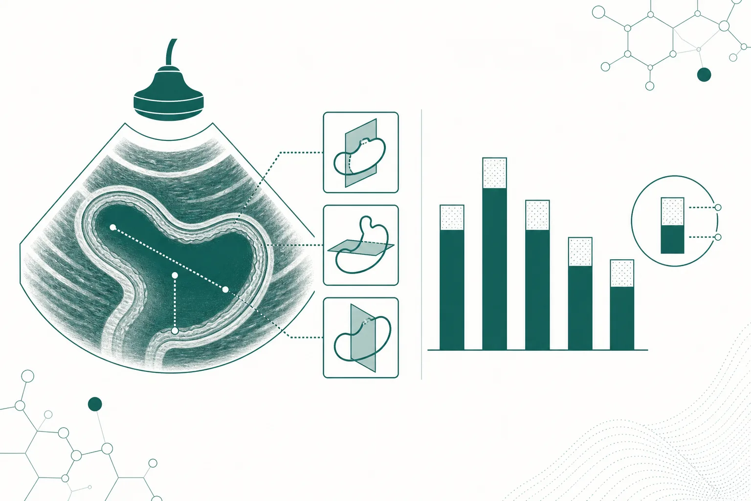 Schematic gastric antrum ultrasound cross-section with measurement planes beside a bar comparison of prevalence proportions